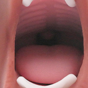 Textured Oral Part
