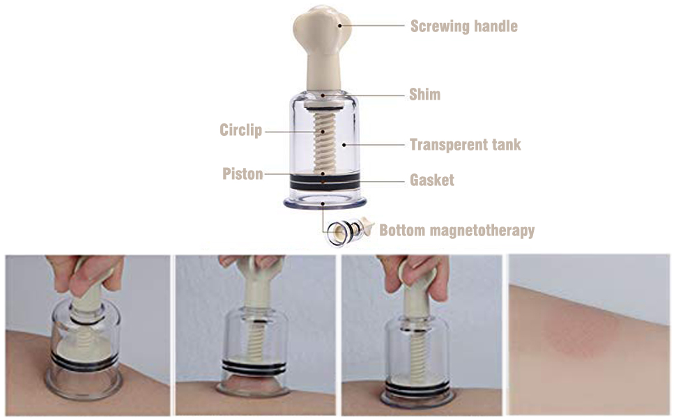 Vacuum twist suction cupping device