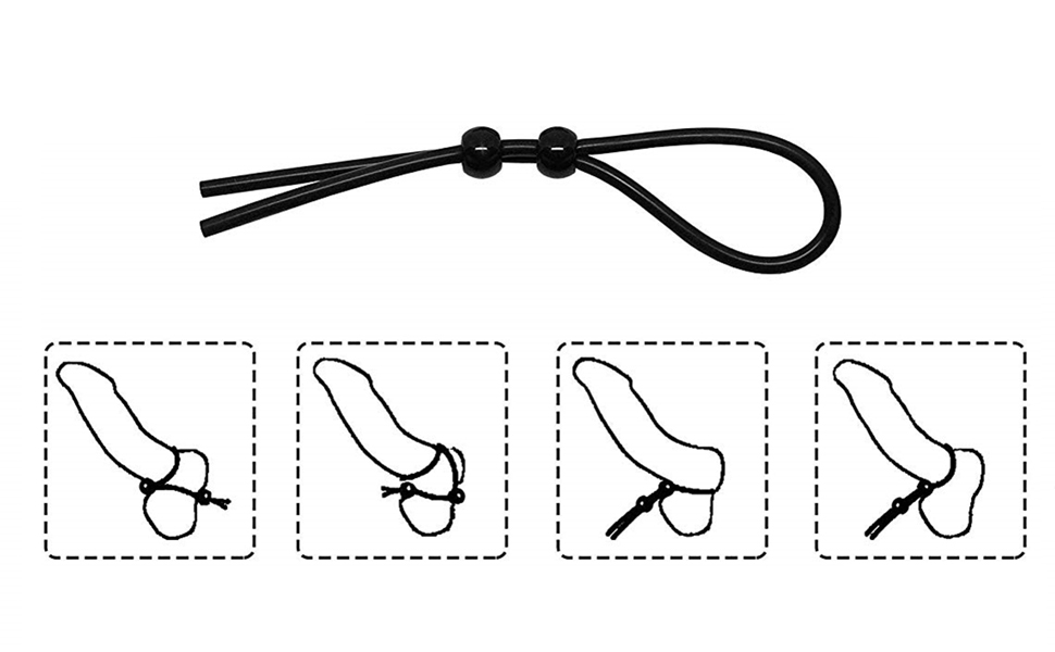 1 Loop