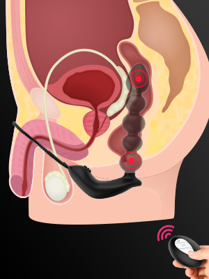 Butt plug